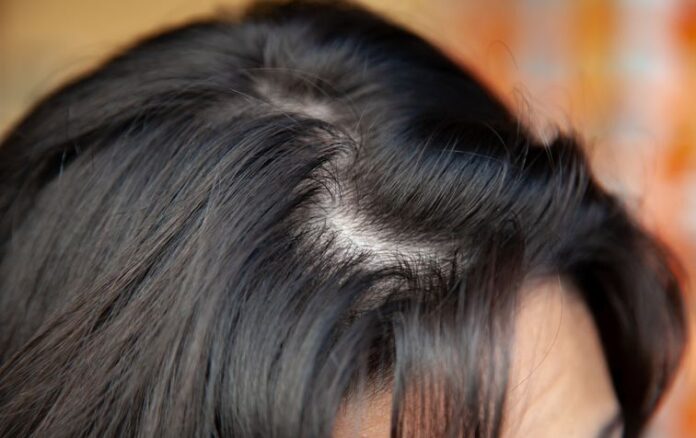 7 Signs That Using Relaxers is Damaging Your Hair